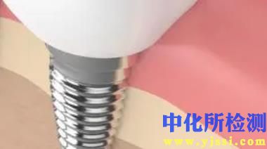 種植體測(cè)試